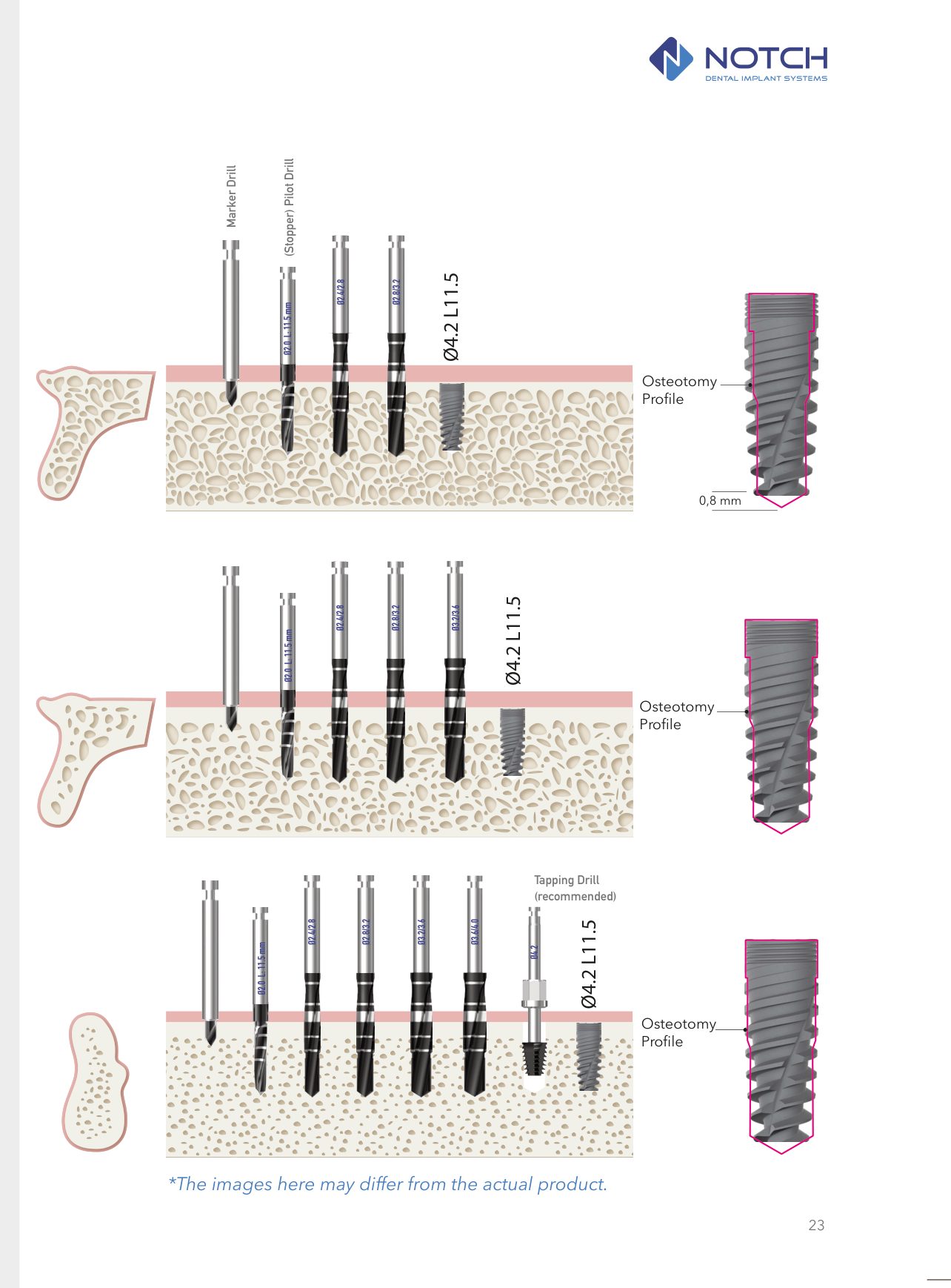 SMART&trade; official drilling protocol diagram — D4, D3, D2