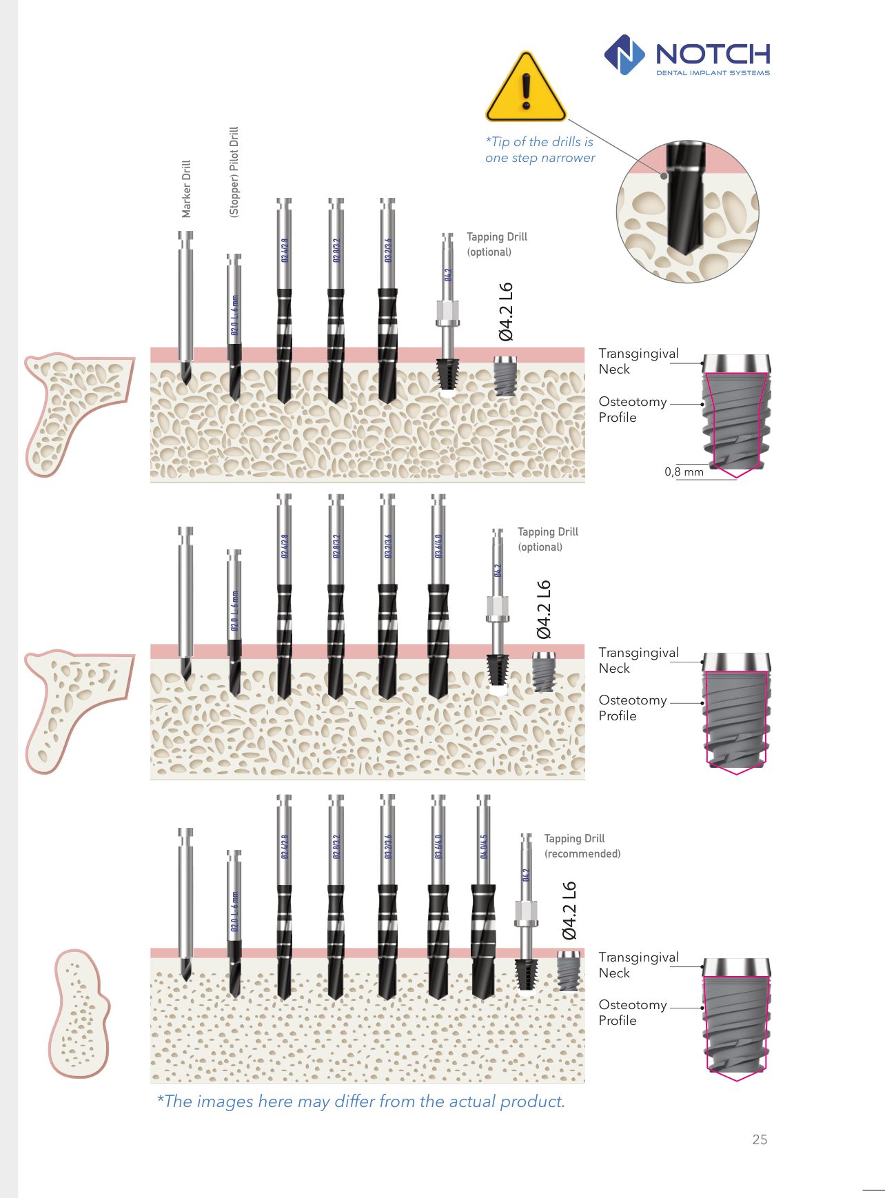 SHORT&trade; official drilling protocol diagram — D4, D3, D2